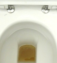 Urin in der Toilette