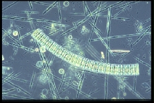 bersichtfoto der Planktongemeinschaft drei Wochen nach Eisendngung. Typische Arten sdpolarer Kieselalgen dominieren die knstliche induzierte Blte. (Foto: Philipp Assmy, Alfred-Wegener-Institut)