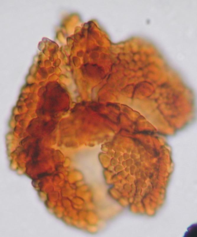 Pollen von Ricciisporites tuberculatus, einer Pflanze, die in der Sptphase des Trias blhte und beim Massensterben vor 200 Millionen Jahren verschwand. (Foto: Sofie Lindstrm)