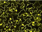 Epidermale Zellen einer Arabidopsis-Linie, deren Immunsystem aktiviert wurde. Die hchste Expression des fluoreszenzmarkierten Proteins EDS1 findet sich im Zytoplasma und im Kern der Zellen. 
