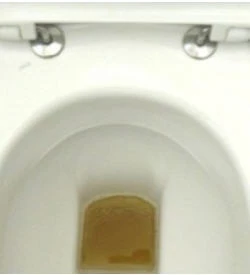 Urin gehrt in die Toilette