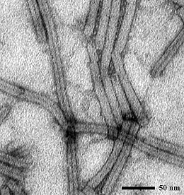 Elektronenmikroskopische Aufnahme des Soil Borne Cereal Mosaic Virus (SBCMV) (Quelle: JKI/Quedlinburg)