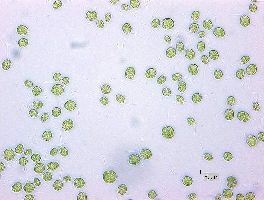 Lichtmikroskopische Aufnahme der Grnalge Chlamydomonas reinhardtii (Zelldurchmesser ca. 10 Mikrometer). (Foto: RUB)