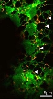 Teil einer Epidermiszelle aus einem Tabakblatt: Das Netzwerk des Endoplasmatischen Retikulums ist durch ein spezielles Markerprotein grn visualisiert. (Bild: Uni Heidelberg)